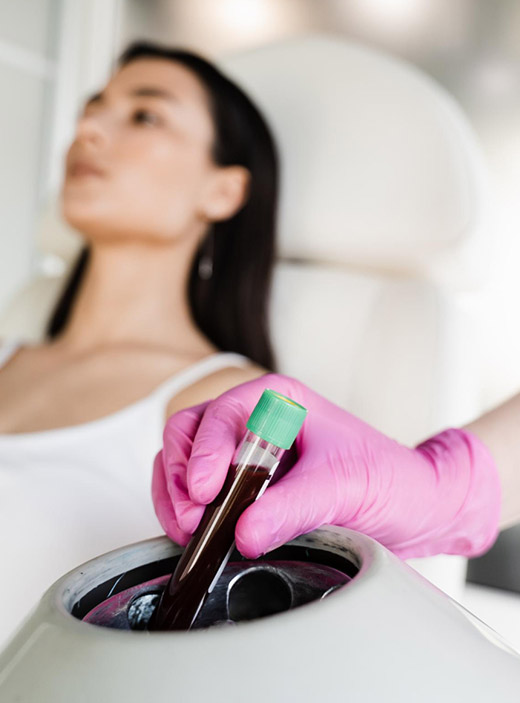 PRP (Platelet Rich Plasma)